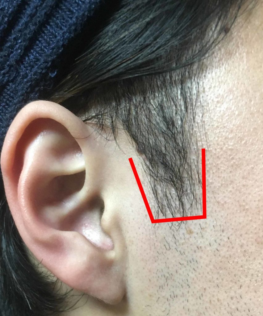 自分で決めたもみあげの範囲