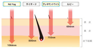 ヤグレーザーの波長