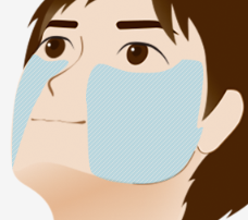 湘南美容クリニックヒゲ脱毛範囲2